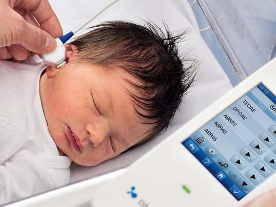 新生儿听力正常的表现