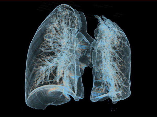肺癌治疗