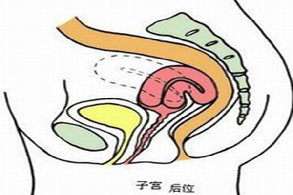 子宫后位是什么 会影响女性“好孕”吗