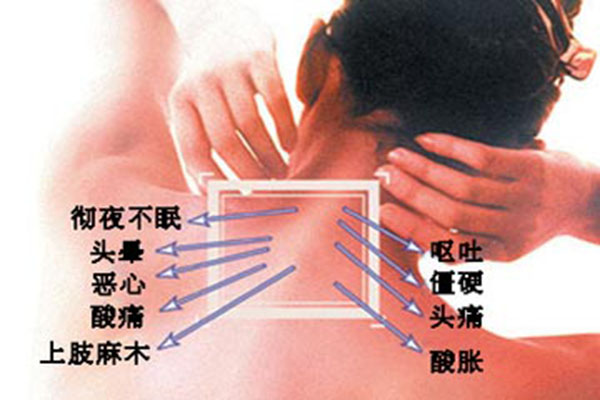 颈部软组织损伤应该如何治疗？