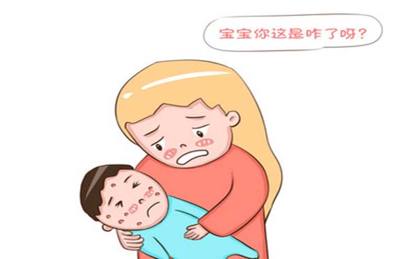 小孩出水痘了怎么办？