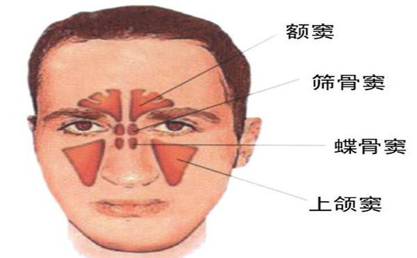 鼻炎和鼻窦炎有什么区别呢？