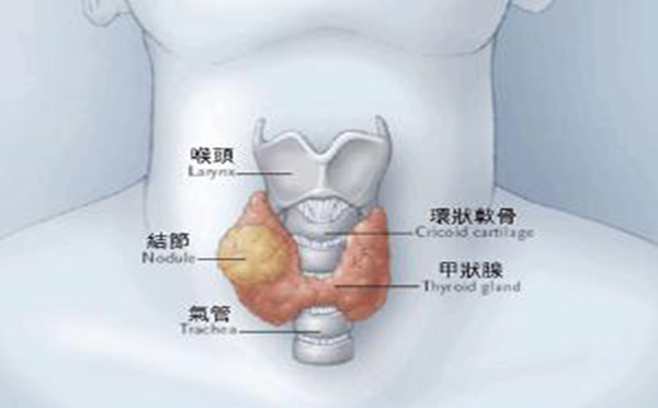 甲状腺癌手术后如何复查和治疗