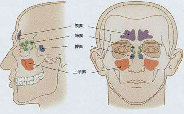 鼻窦炎对孩子有哪些影响