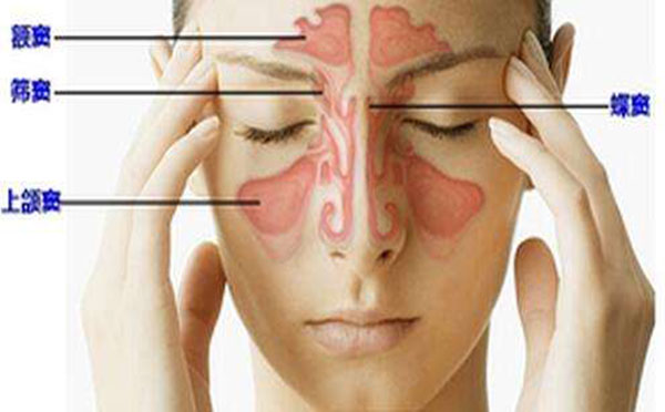 诱发鼻窦炎的原因有哪些