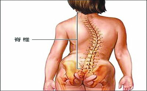 脊椎侧弯有哪些具体表现