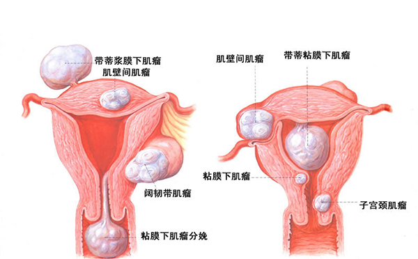 闭经原因有哪些 五大原因导致闭经