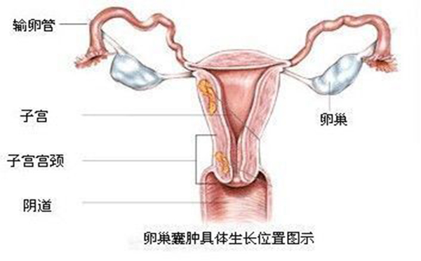 闭经原因有哪些 五大原因导致闭经