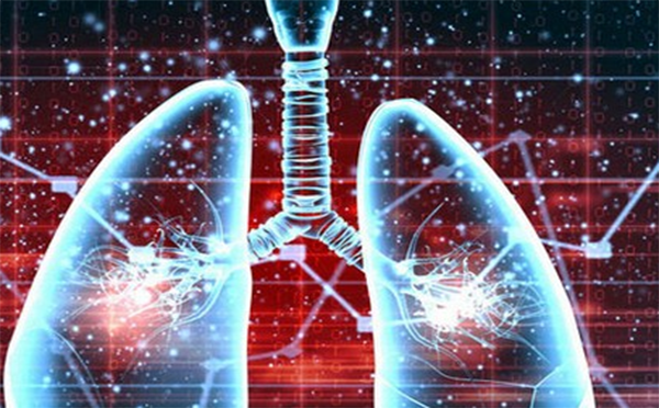 专家为您解答肺纤维化的发病因素有什么呢