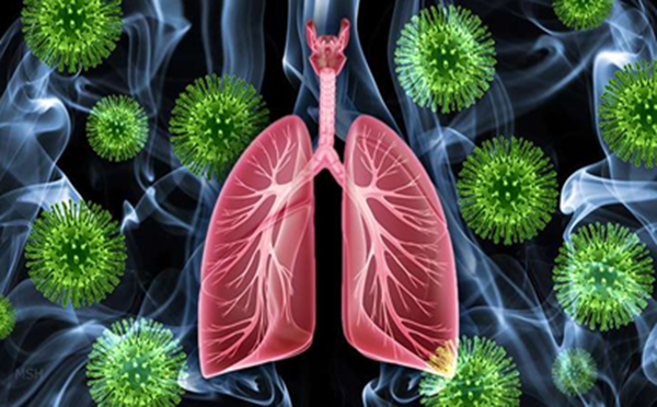 专家向您解答肺纤维化的并发症有哪些
