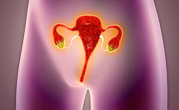 子宫内膜异位病症如何预防呢 专家向您解答