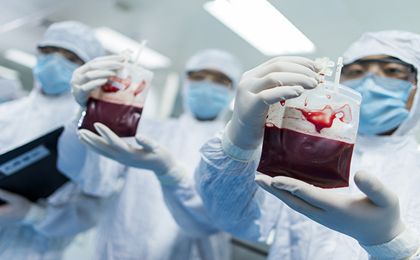 专家提示造血干细胞移植的危害你知道吗