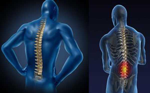 强直性脊柱炎的发病原因有哪些 专家向您解答