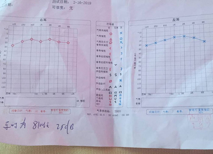 求解决耳朵持续蝉鸣