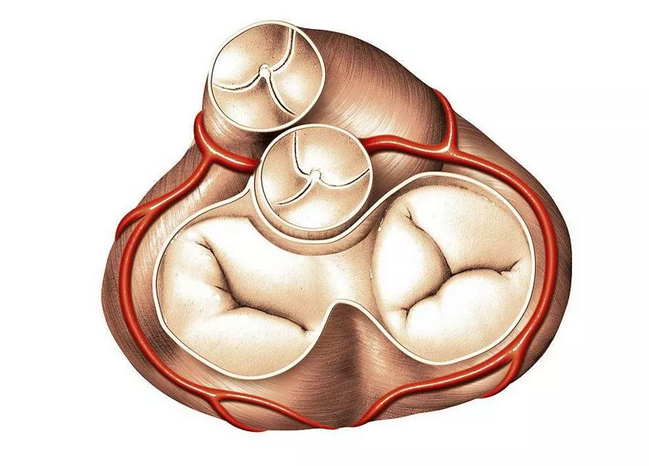 心脏二三尖瓣轻度反流是什么意思