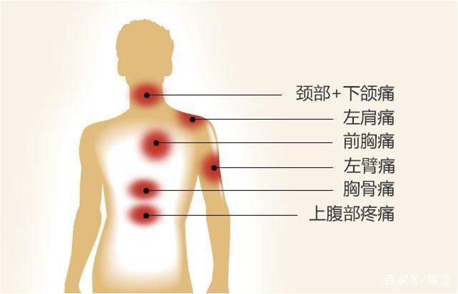 什么位置疼说明心绞痛