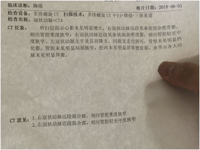 低密度脂蛋白胆固醇多少斑块逆转——影像检查结果