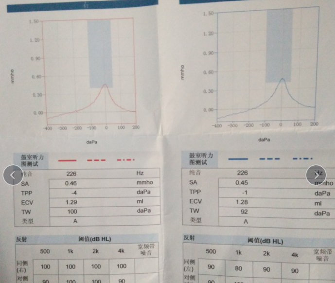 鼻炎可以引起耳鸣吗