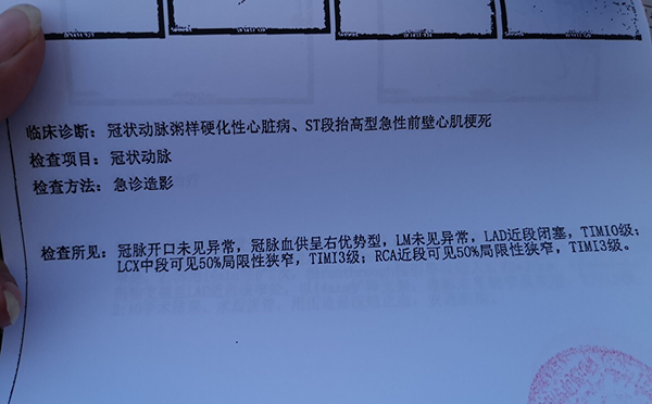 冠状动脉粥样硬化性心脏病严重吗