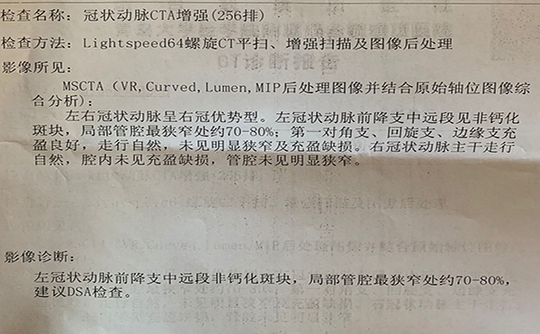 心梗做造影就做支架吗