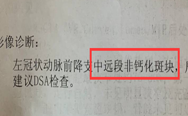 心梗做造影就做支架吗