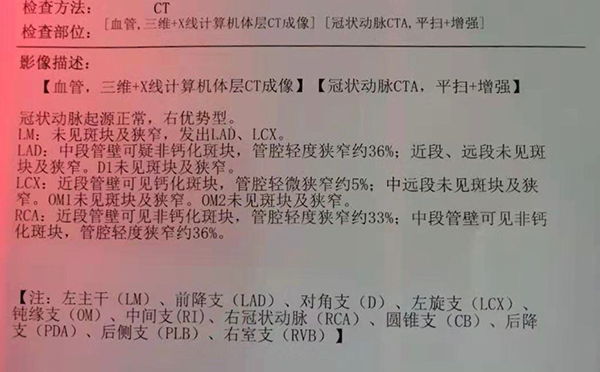 管腔轻度狭窄是冠心病吗