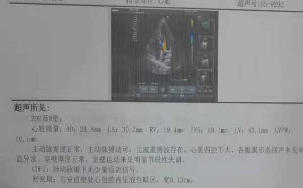 心包积液严重吗