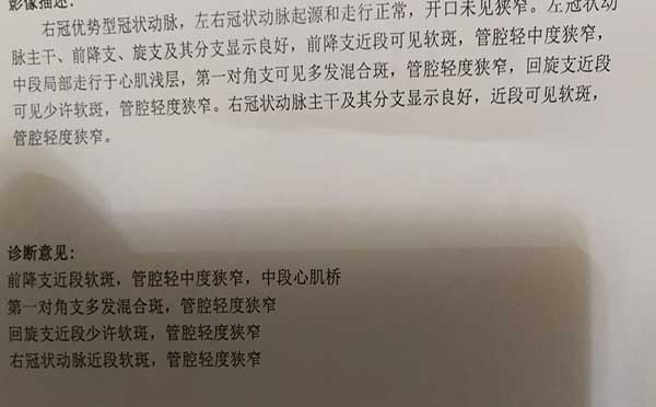 管腔轻中度狭窄严重吗